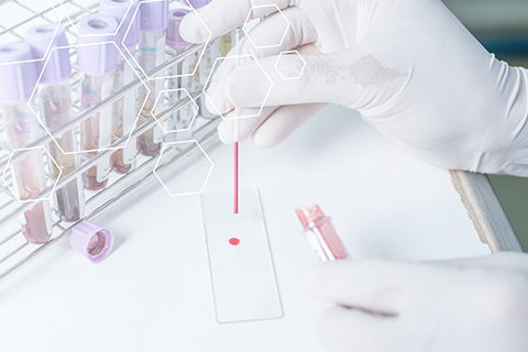 blood work in a lab